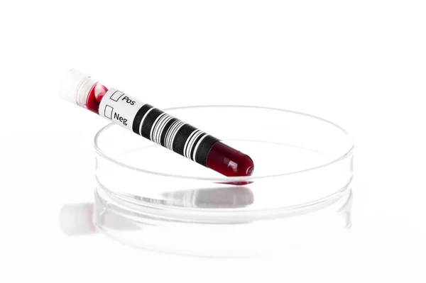 Tubo Amostra Sangue Líquido Vermelho Uma Placa Petri Laboratório Análises — Fotografia de Stock