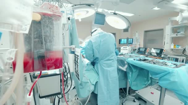 Los Médicos Están Realizando Una Cirugía Quirófano — Vídeo de stock