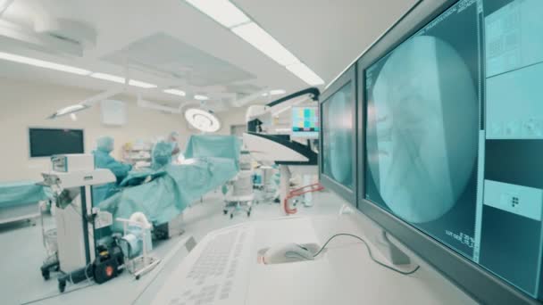 手术室里有扫描和一组做手术的医生 — 图库视频影像