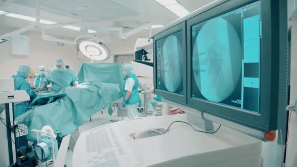 外科医のグループと手術室 — ストック動画