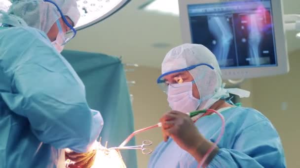 Dois Cirurgiões Estão Realizando Cirurgia Ortopédica — Vídeo de Stock