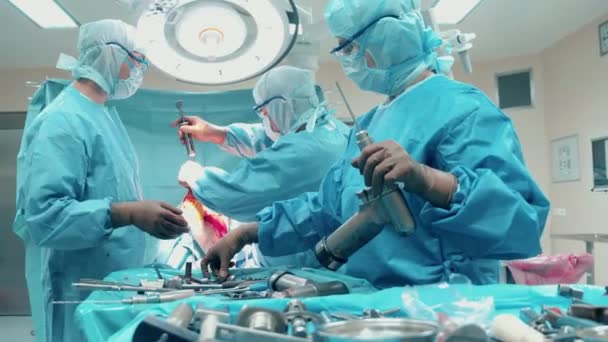 外科医は整形外科手術中に掘削ツールを使用しています — ストック動画
