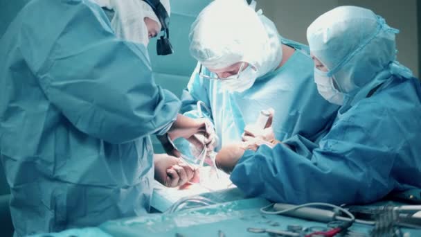 Equipa Cirurgiões Está Realizar Uma Operação Invasiva — Vídeo de Stock