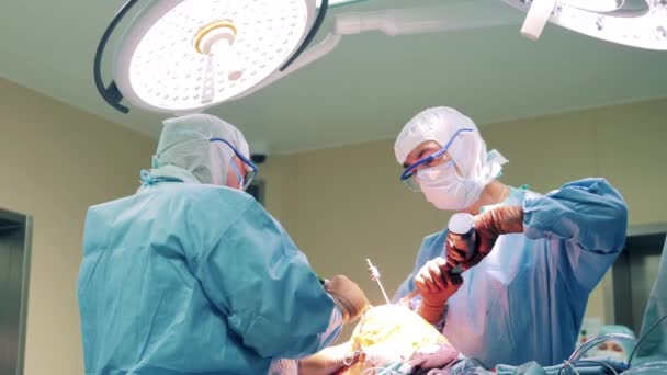 Два Хирурга Работают Над Ногой Пациента — стоковое видео