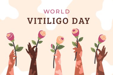 Dünya Vitiligo Günü. Vitiligo bantlı çeşitli kadın elleri. Çiçek tutan farklı milletlerden kadınların elleri. Deri çeşitliliği kavramı. Vücut pozitifliği ve kendini sevme. Vektör illüstrasyonu