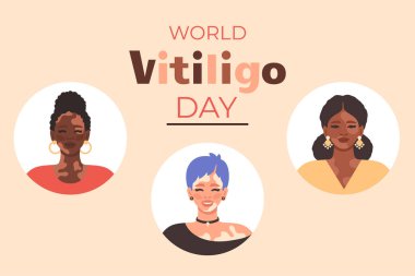 Dünya Vitiligo Günü pankartı. Vitiligo bantları olan çeşitli kadınlar. Vitiligo 'lu mutlu insanlar gülümsüyor. Kabullenmeyi, eşitliği ve cilt pozitifliğini teşvik ediyor. Vektör yassı çizgi film İllüstrasyonu