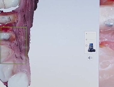 Diş hekimi hastalara muayene eder ve kaplamayı gösterir. Arka planda üç boyutlu bir fotoğraf var. Diş hekimliği. Ameliyat..