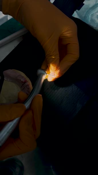 用清洁的方法进行牙齿抛光的近距离医疗牙科医生检查 Mexico Latin America Ica — 图库视频影像