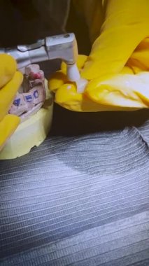 Diş tellerini diş hekimindeki bir kızın dişçi muayenehanesindeki diş tellerinden çıkarma işlemi sırasında sabit diş teli takmak.