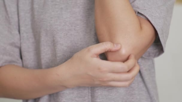 Close Man Scratching Itchy Elbow Skin Disease Allergy Dermatitis Rash — Stock Video