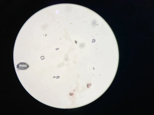 Vista Microscópica Cristales Estruvita Sedimentos Urinarios Cristales Fosfato Magnesio Amonio —  Fotos de Stock