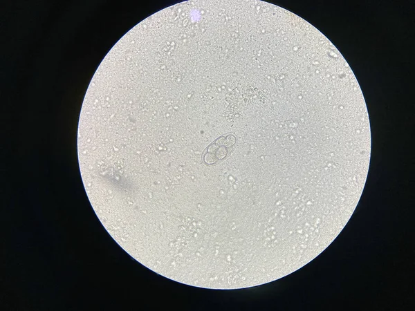便検査で寄生虫のフックワームの卵 — ストック写真