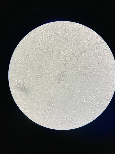 便検査で寄生虫のフックワームの卵 — ストック写真