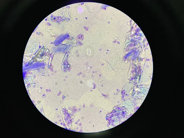 Mikroskopische Ansicht Von Malassezia Pachydermatis Zellen Von Hund Mit Ohrinfektion — Stockfoto