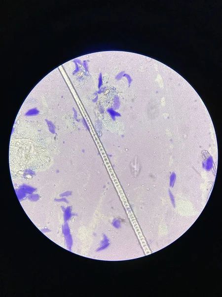 犬耳部感染性帕奇皮炎细胞的显微观察 — 图库照片