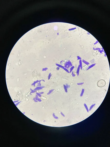 Mikroskopický Pohled Malassezia Pachydermatis Buněk Odebraných Psa Ušní Infekcí — Stock fotografie