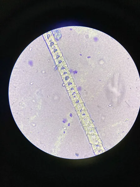 Vista Microscópica Las Células Malassezia Pachydermatis Tomadas Del Perro Con — Foto de Stock