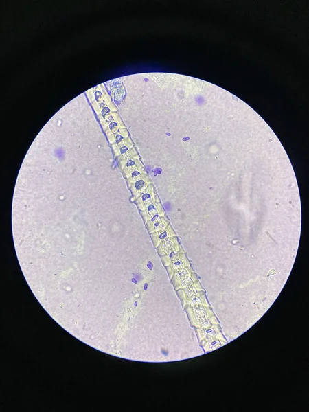 Mikroskopowy Widok Komórek Malassezia Pachydermatis Pobranych Psa Zakażeniem Ucha — Zdjęcie stockowe