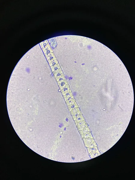 Μικροσκοπική Άποψη Των Κυττάρων Malassezia Pachydermatis Που Λαμβάνονται Από Σκύλο — Φωτογραφία Αρχείου