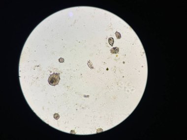 Notoedres Cati mikroskop altında. Notoedric uyuz, Notoedric uyuz olarak da bilinir, Notoedres cati adında bir ektoplazitik ve deri oymacısı tarafından son derece bulaşıcı bir deri istilasıdır..