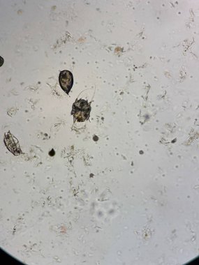 Notoedres Cati mikroskop altında. Notoedric uyuz, Notoedric uyuz olarak da bilinir, Notoedres cati adında bir ektoplazitik ve deri oymacısı tarafından son derece bulaşıcı bir deri istilasıdır..