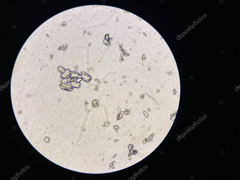 Feline struvite crystals cheap
