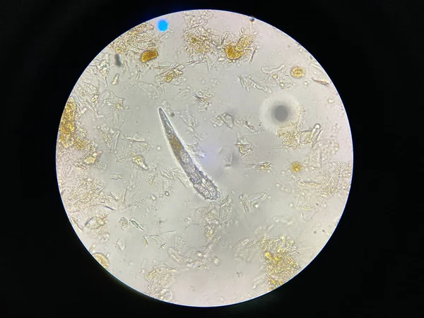 Demodex Mange Microscope View Parasite Causing Skin Disease Demodecosis — стоковое фото