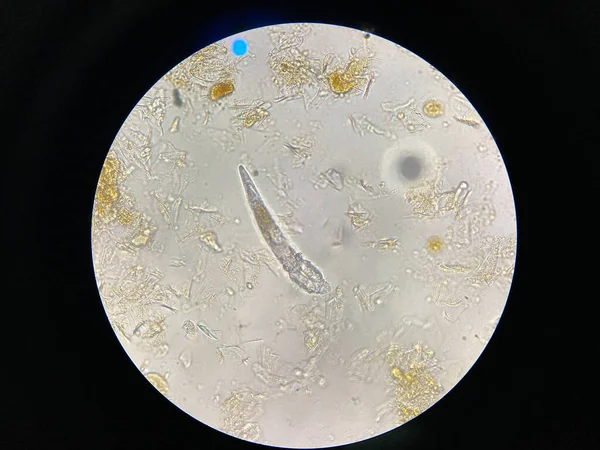 Ψώρα Του Demodex Από Μικροσκόπιο Παράσιτο Που Προκαλεί Μια Ασθένεια — Φωτογραφία Αρχείου