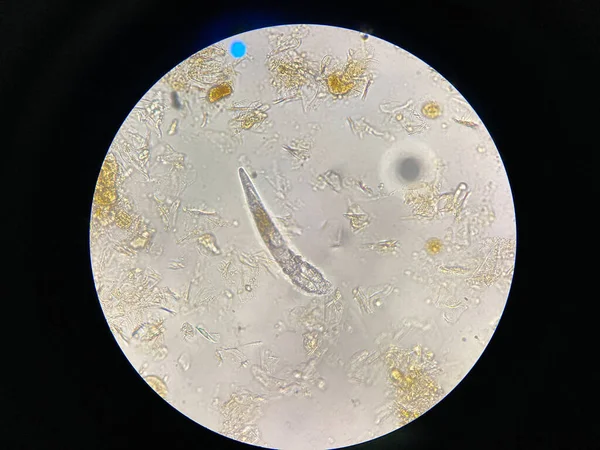 Demodex Mange Microscope View Parasite Causing Skin Disease Demodecosis — Stock Photo, Image
