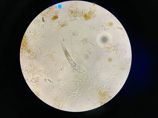 현미경으로 피부병을 일으키는 기생충 — 스톡 사진