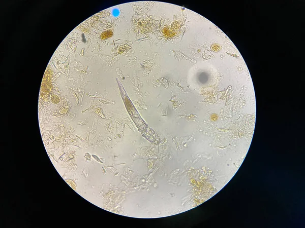 Demodex Mange Microscope View Parasite Causing Skin Disease Demodecosis — стоковое фото