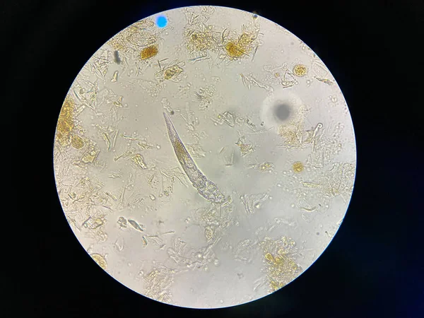 Demodex Mange Microscope View Parasite Causing Skin Disease Demodecosis — Stock Fotó