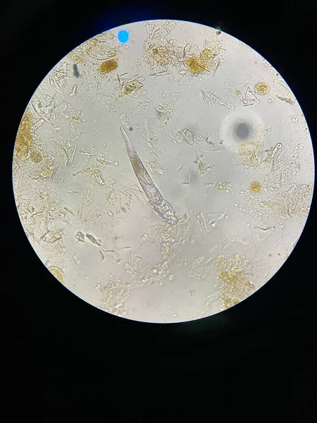 Мбаппе Судя Взгляду Микроскопа Паразит Вызывающий Кожные Заболевания Демодекоз — стоковое фото