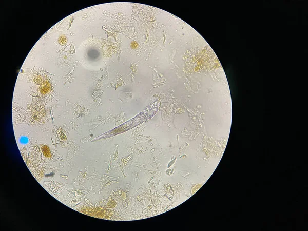 Mikroskop Açısından Demodeks Uyuz Parazit Cilt Hastalığına Neden Oluyor — Stok fotoğraf
