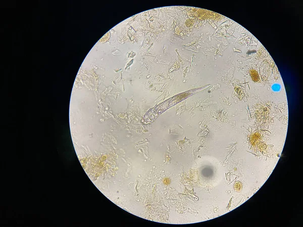 Ψώρα Του Demodex Από Μικροσκόπιο Παράσιτο Που Προκαλεί Μια Ασθένεια — Φωτογραφία Αρχείου
