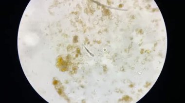 Demodex mange from a microscope view. The parasite causing a skin disease -Demodecosis.