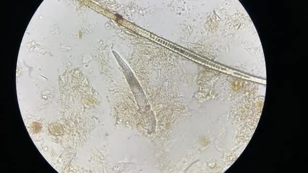 Demodex Mange Microscope View Parasite Causing Skin Disease Demodecosis — стокове відео