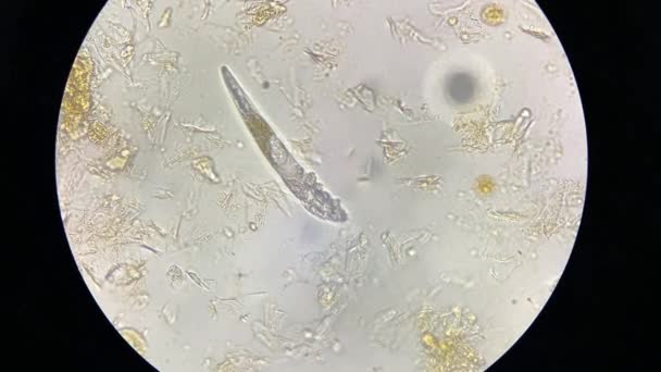 Demodex Mange Microscope View Parasite Causing Skin Disease Demodecosis — Vídeo de Stock