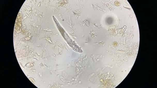 Demodex Mange Microscope View Parasite Causing Skin Disease Demodecosis — стоковое видео