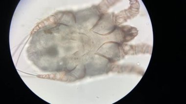 Otodectes cynotis, or ear mites under the microscope. This mites are found in cat's ear.