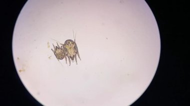 Otodectes cynotis, or ear mites under the microscope. This mites are found in cat's ear.