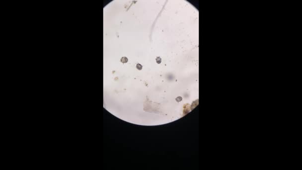 Notoedres Cati Bajo Microscopio Sarna Notoédrica También Conocida Como Sarna — Vídeos de Stock
