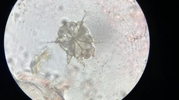 Notoedres Cati Bawah Mikroskop Kudis Notoedric Juga Disebut Kudis Feline — Stok Video