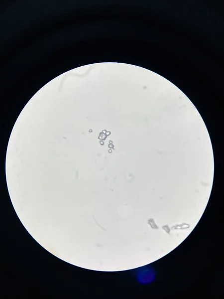 Vista Microscopica Cristalli Struvite Sedimenti Urinari Cristalli Magnesio Ammonio Fosfato — Foto Stock