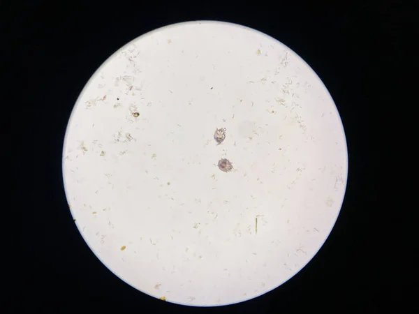 Notoedres Cati Microscope Notoedric Mange Also Referred Feline Scabies Highly — Stock Photo, Image