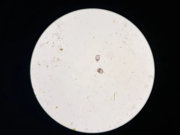 Notoedres cati under the microscope. Notoedric mange, also referred to as Feline scabies, is a highly contagious skin infestation caused by an ectoparasitic and skin burrowing mite Notoedres cati.