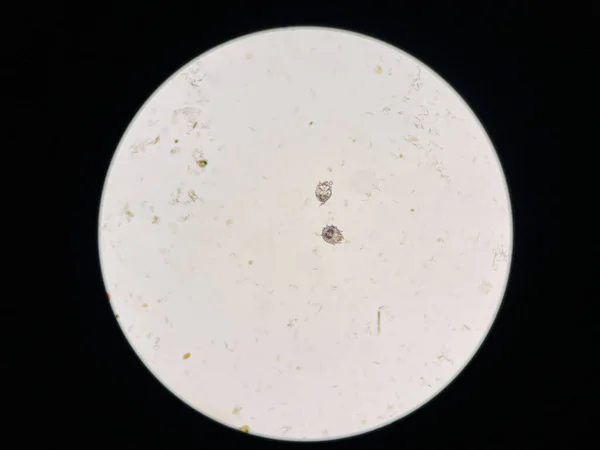 현미경으로 사람들 입니다 Notoedric Mange Feline Scabies 기생충에 전염성 감염이며 — 스톡 사진