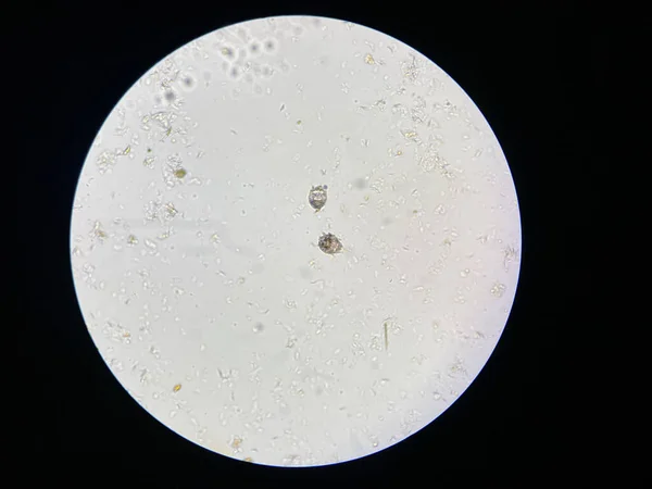 Notoedres Cati Microscopio Rogna Notoedrica Detta Anche Scabbia Felina Infestazione — Foto Stock
