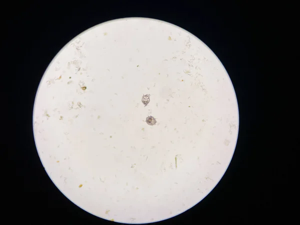 Notoedres Cati Pod Mikroskopem Notoedric Svrabu Také Nazývané Feline Strupy — Stock fotografie