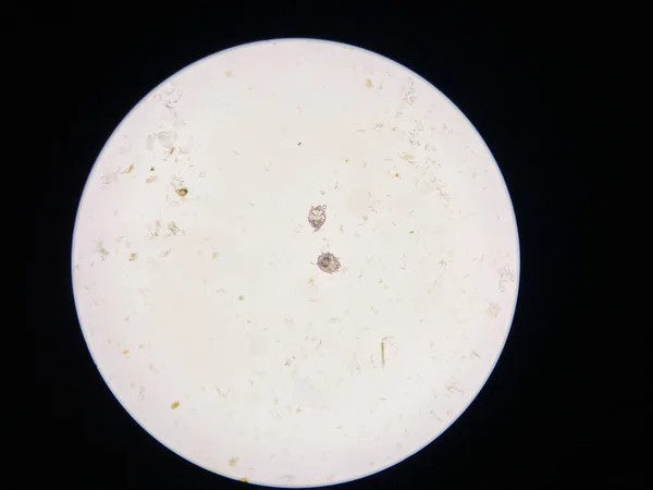 Notoedres Cati Microscope Notoedric Mange Also Referred Feline Scabies Highly — Stock Photo, Image